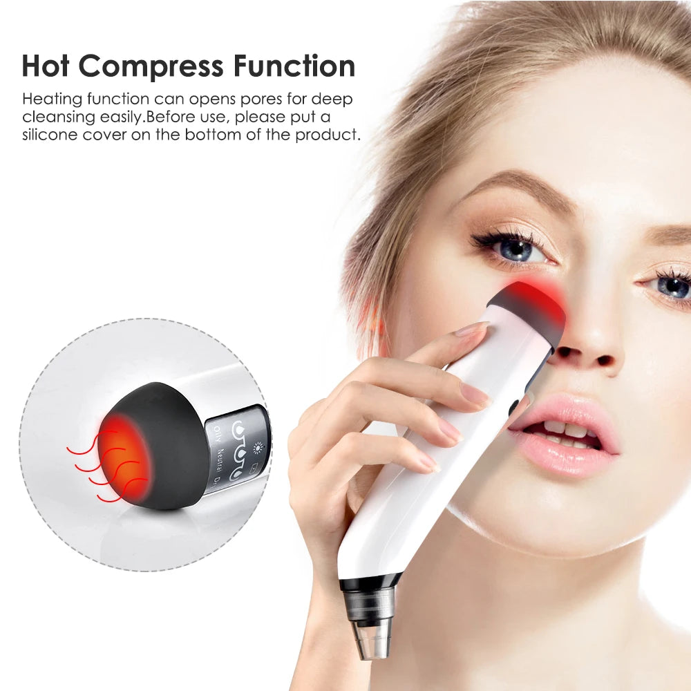 Aspirateur Anti-Points Noirs Électrique USB – Nettoyant Facial 3 Niveaux & 4 Têtes