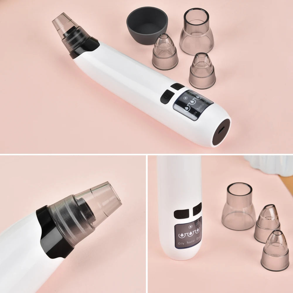 Aspirateur Anti-Points Noirs Électrique USB – Nettoyant Facial 3 Niveaux & 4 Têtes